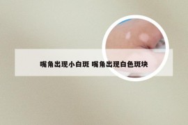 嘴角出现小白斑 嘴角出现白色斑块