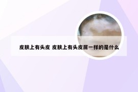 皮肤上有头皮 皮肤上有头皮屑一样的是什么