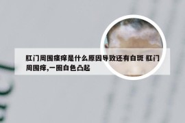 肛门周围瘙痒是什么原因导致还有白斑 肛门周围痒,一圈白色凸起