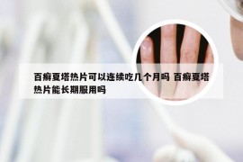 百癣夏塔热片可以连续吃几个月吗 百癣夏塔热片能长期服用吗