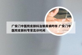 广安门中医院皮肤科治银屑病咋样 广安门中医院皮肤科专家出诊时间