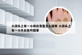 小孩头上有一小块白发是怎么回事 小孩头上有一小片白色咋回事