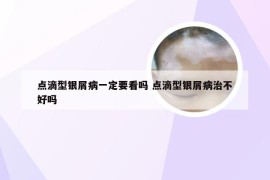 点滴型银屑病一定要看吗 点滴型银屑病治不好吗