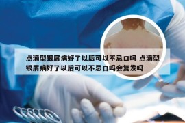 点滴型银屑病好了以后可以不忌口吗 点滴型银屑病好了以后可以不忌口吗会复发吗