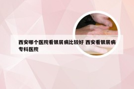 西安哪个医院看银屑病比较好 西安看银屑病专科医院