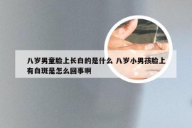 八岁男童脸上长白的是什么 八岁小男孩脸上有白斑是怎么回事啊