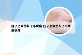 肚子上突然长了小块癣 肚子上突然长了小块癣很痒