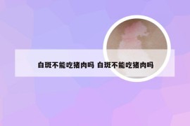 白斑不能吃猪肉吗 白斑不能吃猪肉吗