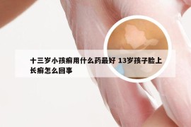 十三岁小孩癣用什么药最好 13岁孩子脸上长癣怎么回事