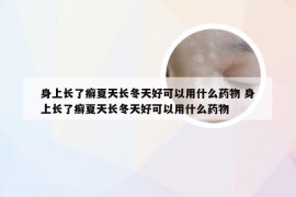 身上长了癣夏天长冬天好可以用什么药物 身上长了癣夏天长冬天好可以用什么药物