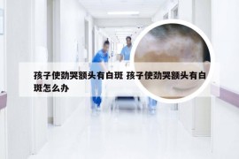 孩子使劲哭额头有白斑 孩子使劲哭额头有白斑怎么办