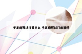 手足癣可以打香皂么 手足癣可以打疫苗吗