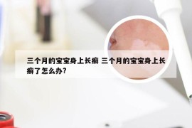 三个月的宝宝身上长癣 三个月的宝宝身上长癣了怎么办?