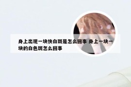 身上出现一块快白斑是怎么回事 身上一块一块的白色斑怎么回事