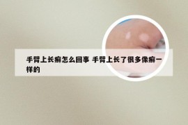 手臂上长癣怎么回事 手臂上长了很多像癣一样的