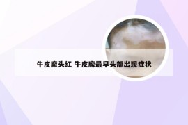 牛皮廨头红 牛皮廨最早头部出现症状