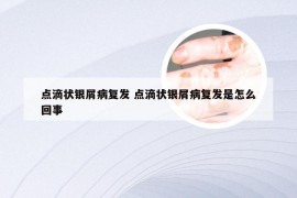 点滴状银屑病复发 点滴状银屑病复发是怎么回事