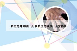 白斑是身体缺什么 长白斑是缺少什么营养素