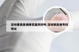 深圳看银屑病哪家医院好吗 深圳银屑病专科地址