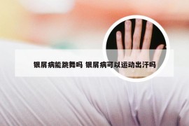 银屑病能跳舞吗 银屑病可以运动出汗吗