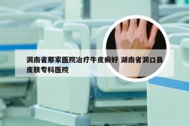 洞南省那家医院冶疗牛皮癣好 湖南省洞口县皮肤专科医院