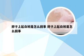 脖子上起白班是怎么回事 脖子上起白班是怎么回事