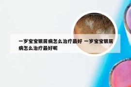 一岁宝宝银屑病怎么治疗最好 一岁宝宝银屑病怎么治疗最好呢