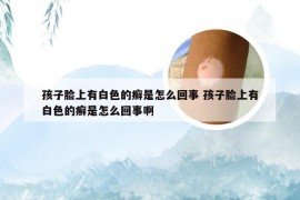 孩子脸上有白色的癣是怎么回事 孩子脸上有白色的癣是怎么回事啊