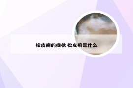 松皮癣的症状 松皮癣是什么