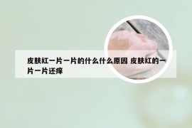 皮肤红一片一片的什么什么原因 皮肤红的一片一片还痒