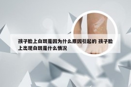 孩子脸上白斑是因为什么原因引起的 孩子脸上出现白斑是什么情况