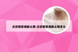 点状银屑病静止期 点状银屑病静止期多久