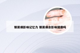 银屑病影响记忆力 银屑病会影响健康吗