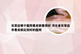 石家庄哪个医院看皮肤看得好 河北省石家庄市看皮肤比较好的医院