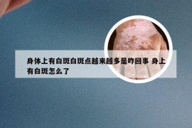 身体上有白斑白斑点越来越多是咋回事 身上有白斑怎么了