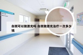 白斑可以做激光吗 白斑做激光治疗一次多少钱