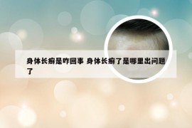 身体长癣是咋回事 身体长癣了是哪里出问题了