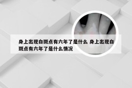 身上出现白斑点有六年了是什么 身上出现白斑点有六年了是什么情况