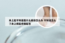 身上起不知道是什么癣该怎么办 不知道怎么了身上痒起疙瘩起包