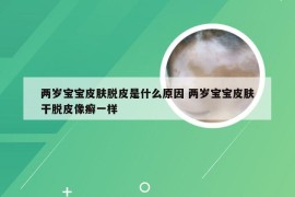 两岁宝宝皮肤脱皮是什么原因 两岁宝宝皮肤干脱皮像癣一样