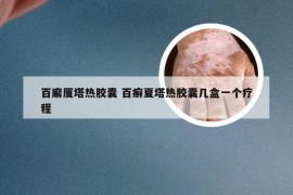 百廨厦塔热胶囊 百癣夏塔热胶囊几盒一个疗程