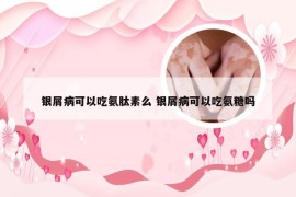 银屑病可以吃氨肽素么 银屑病可以吃氨糖吗