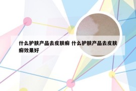 什么护肤产品去皮肤癣 什么护肤产品去皮肤癣效果好