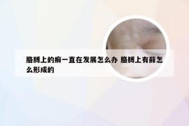 胳膊上的癣一直在发展怎么办 胳膊上有藓怎么形成的