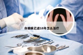 白癫疯已进18年怎么治疗