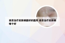 南京治疗皮肤病最好的医院 南京治疗皮肤病哪个好