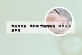 大腿内侧有一块白斑 大腿内侧有一块白斑不痛不痒