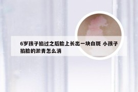 6岁孩子掐过之后脸上长出一块白斑 小孩子掐脸的淤青怎么消