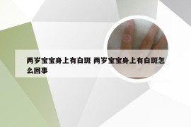 两岁宝宝身上有白斑 两岁宝宝身上有白斑怎么回事