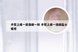 手臂上痒一抓像癣一样 手臂上痒一挠就起小瘩疙